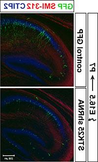 GFP